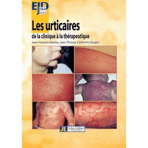Les Urticaires De La Clinique À La Thérapeutique