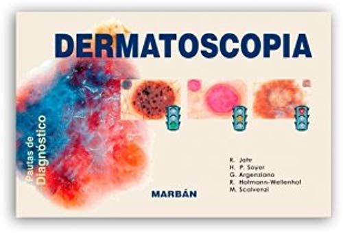 Dermatoscopia - Pautas De Diagnostico (Spanish Edition)
