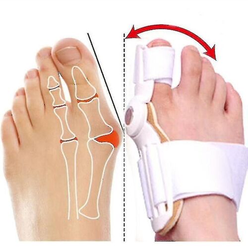 2pcs Attelle Big Toe Redresseur Correcteur Pied Douleur Soulagement Hallux Valgus Correction Pédicure Orthopédique Soins Des Pieds