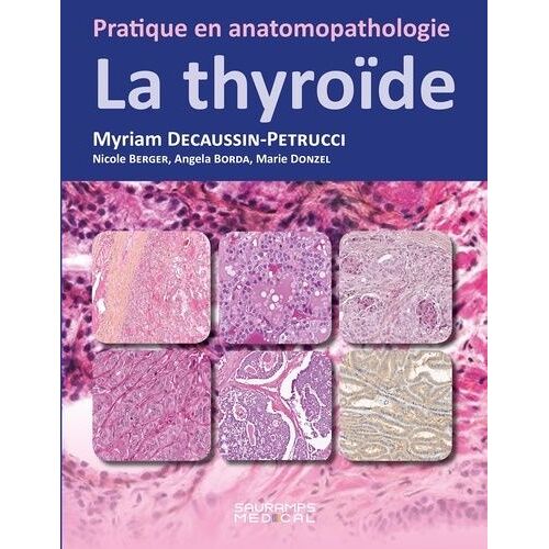 La Thyroïde