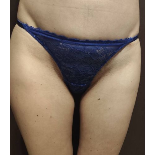 Culotte Bleue