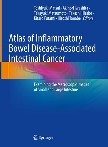 Atlas Of Inflammatory Bowel Disease-Associated Intestinal Cancer
