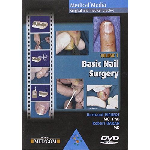 Basic Nail Surgery Version Anglaise