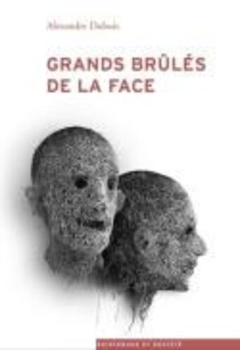 Grands Brûlés De La Face - Epreuves Et Luttes Pour La Reconnaissance