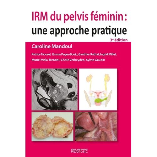 Irm Du Pelvis Féminin - Une Approche Pratique