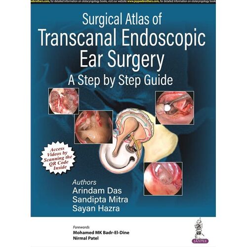 Surgical Atlas Of Transcanal Endoscopic Ear Surgery