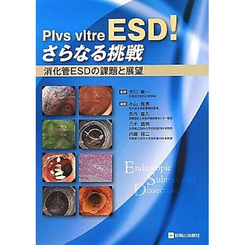 Plvs Vltre Esd!Esd