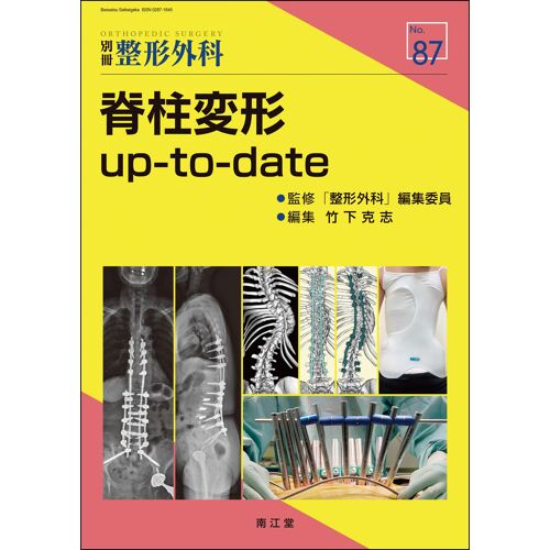Up-To-Date ()