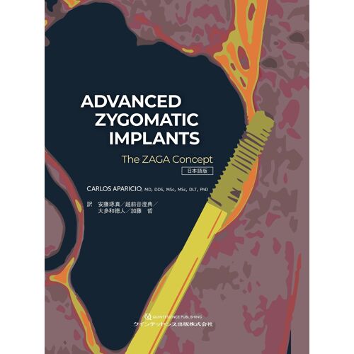 Advanced Zygomatic Implants : The Zaga Concept