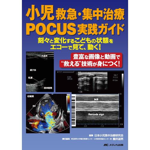 Pocus