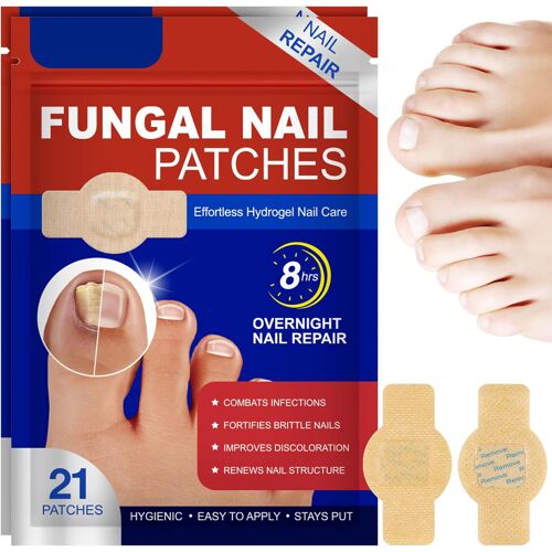 Kalanka-42pcs Fungal Nail Patches, Pansements Antimycosiques Pour Ongles, Renforcement Des Ongles, Réparer Abîmés Patches Antifongiques Ongle Pieds (Beige 42pcs)