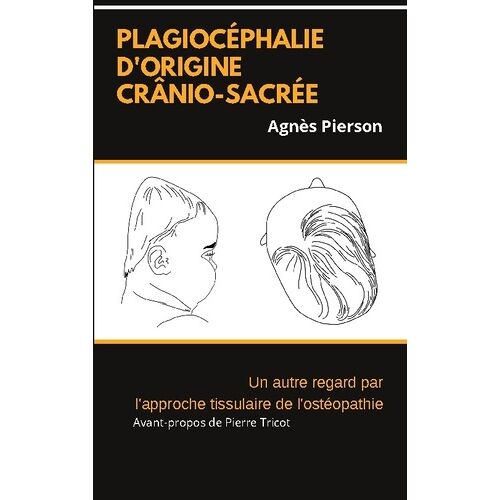 Plagiocéphalie D'origine Crânio-Sacrée - Un Autre Regard Par L'approche Tissulaire De L'ostéopathie