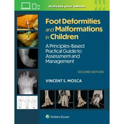 Foot Deformities And Malformations In Children - A Principles-Based, Practical Guide To Assessment And Management