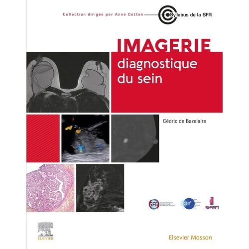 Imagerie Diagnostique Du Sein