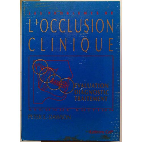 Les Problèmes De L'Occlusion Clinique