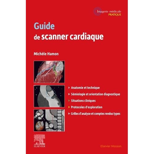 Guide De Scanner Cardiaque